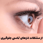 lens1