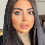 لنز پر طرفدار
