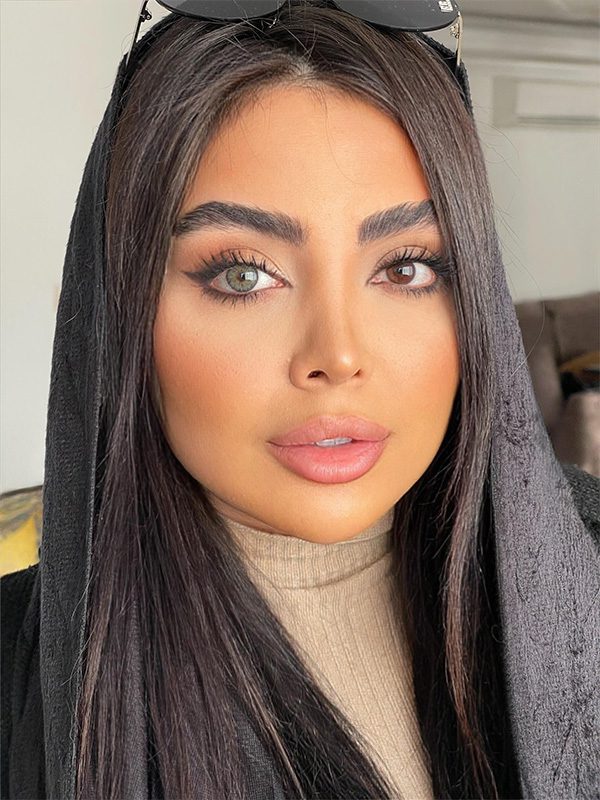لنز پر طرفدار