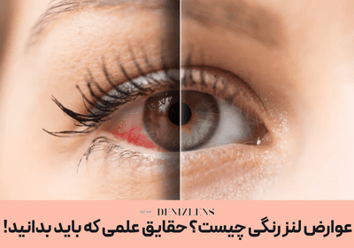 عوارض لنز رنگی چیست؟ حقایق علمی که باید بدانید!