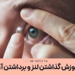 اموزش گذاشتن لنز و برداشتن آن (با عکس و ویدئو)