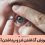 اموزش گذاشتن لنز و برداشتن آن (با عکس و ویدئو)